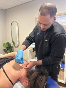 dry needling